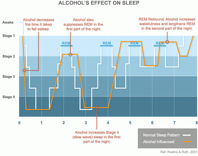 Alcohol's effect on sleep